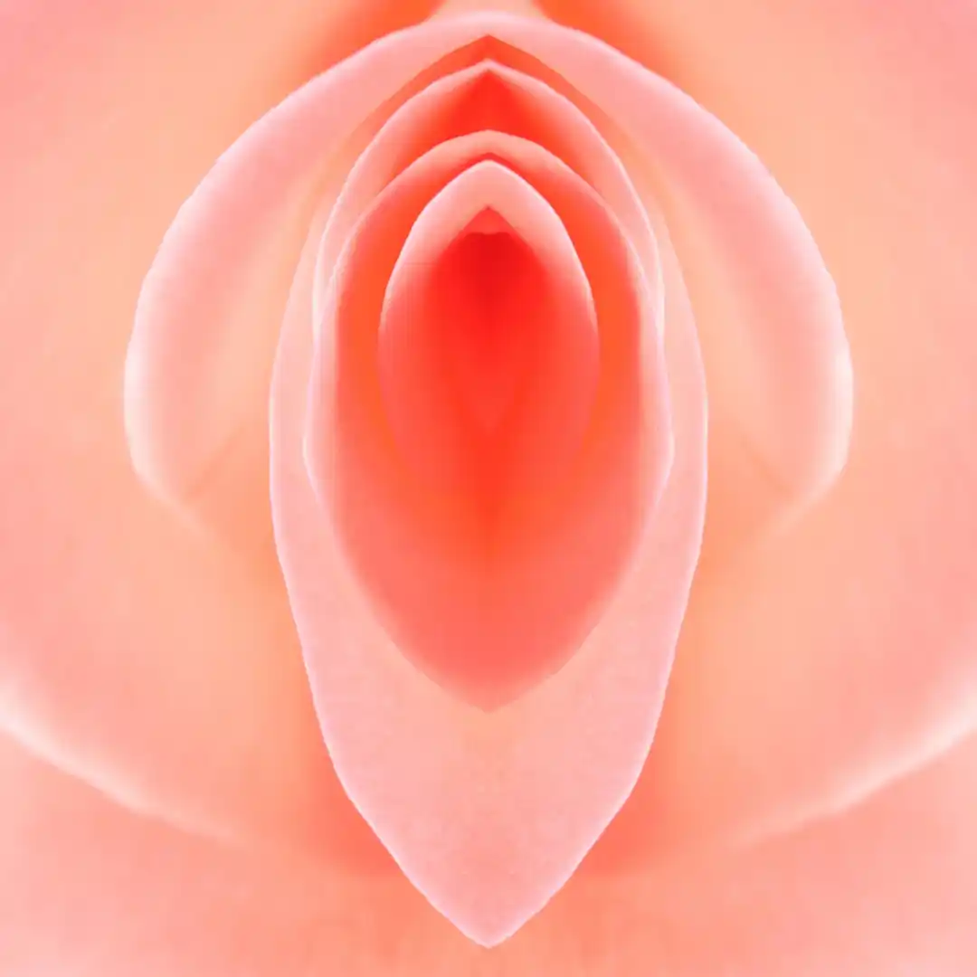 Ninfoplastia resolve a hipertrofia dos pequenos lábios?