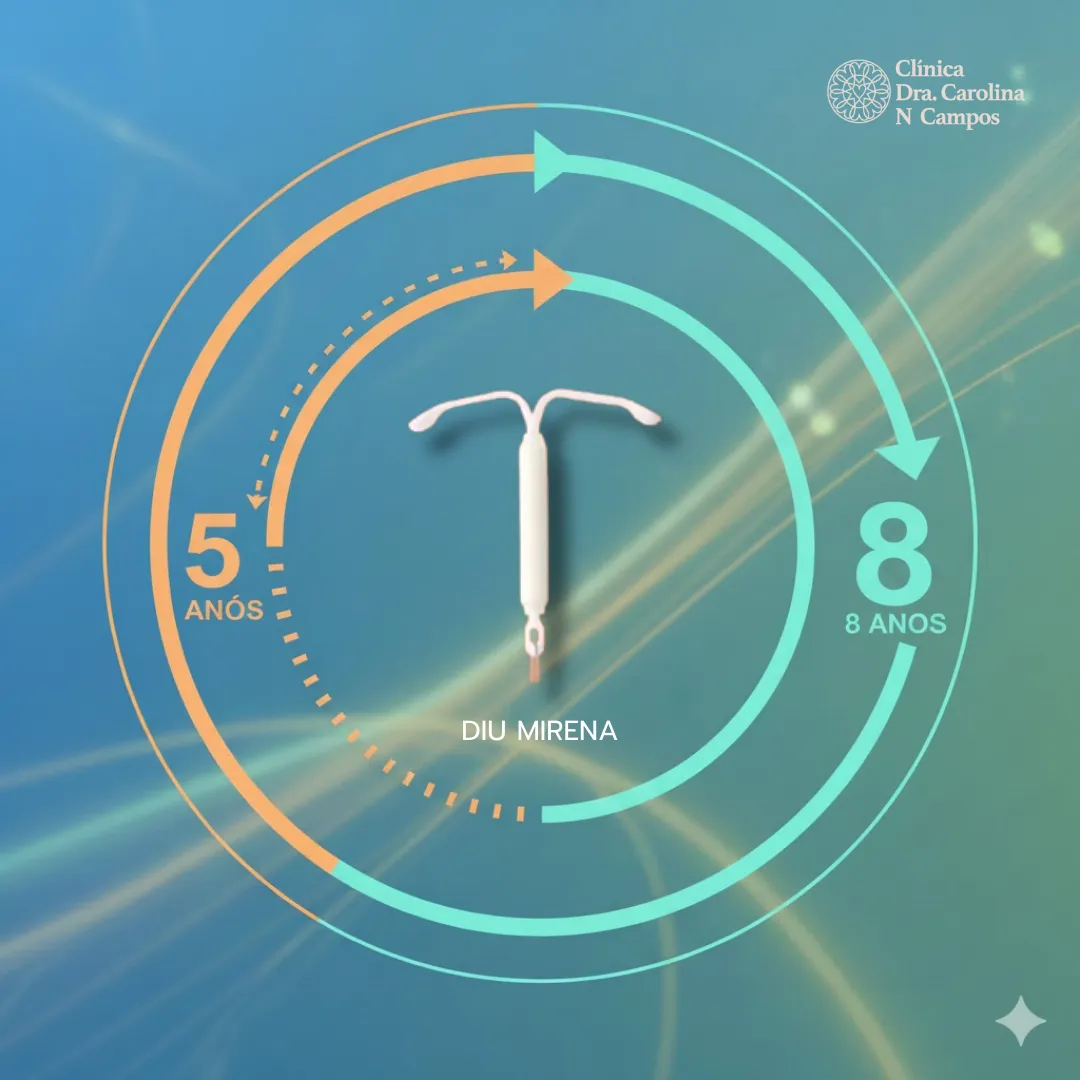 DIU Mirena: agora com validade de 8 anos para contracepção